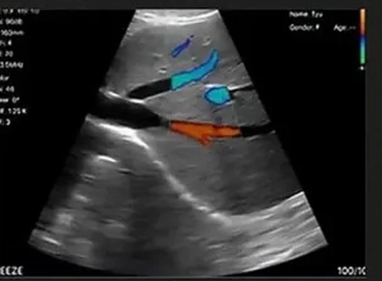 Exame vascular com Doppler colorido no app RC Medical